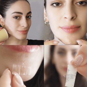 How TikTok viral videos are driving interest in hydrocolloid dressings for acne