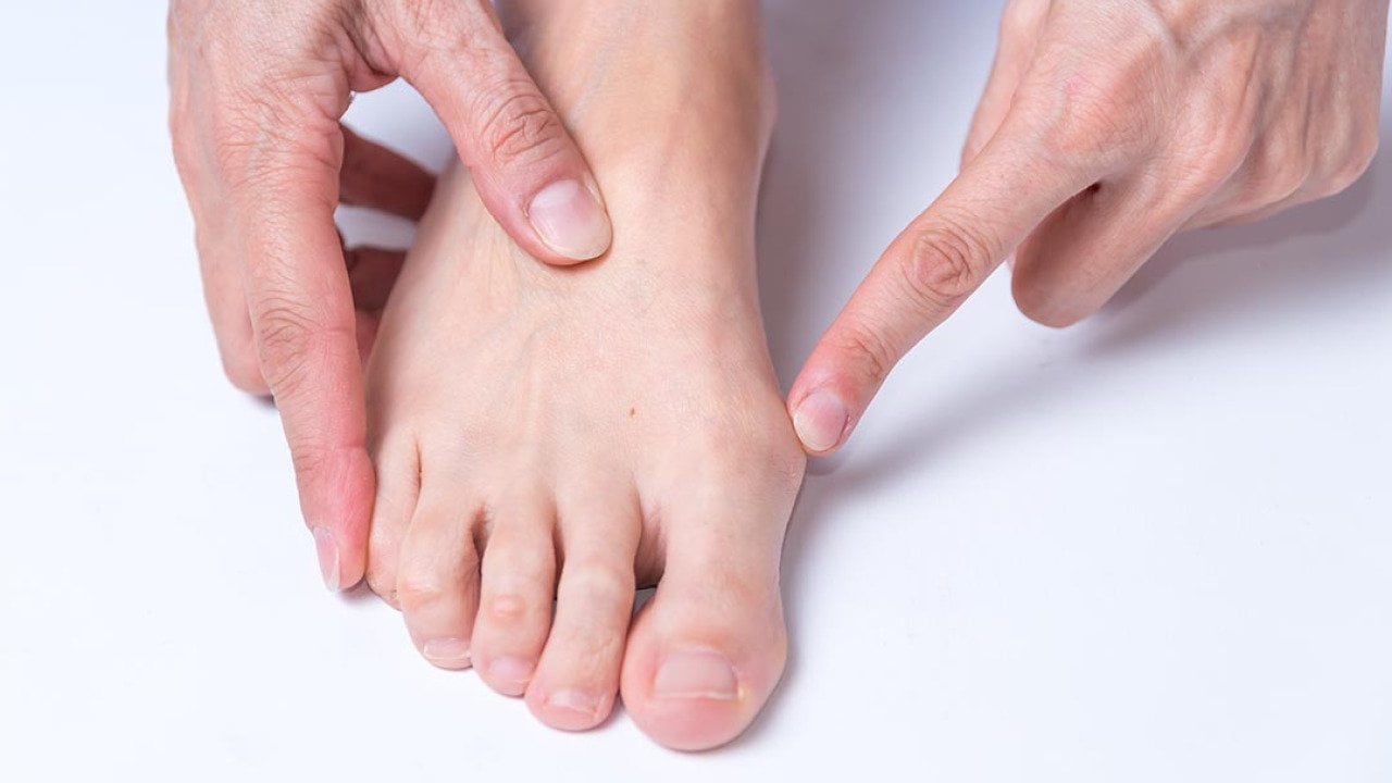 Top down view of light skinned person pointing to the bunion on their right foot.