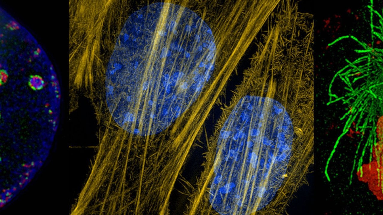 Composite of three mages from new microscope technology show a cell's replication machinery in green, already-replicated DNA is red and DNA bundled into chromatin in blue. At center, the cytoskeleton’s actin fibers in mouse connective tissue cells are seen in yellow; cellular DNA is stained blue. At right is a human cell dividing in two with its genetic material labeled in red, and the spindle apparatus that pulls the sister chromatids apart labeled in green.