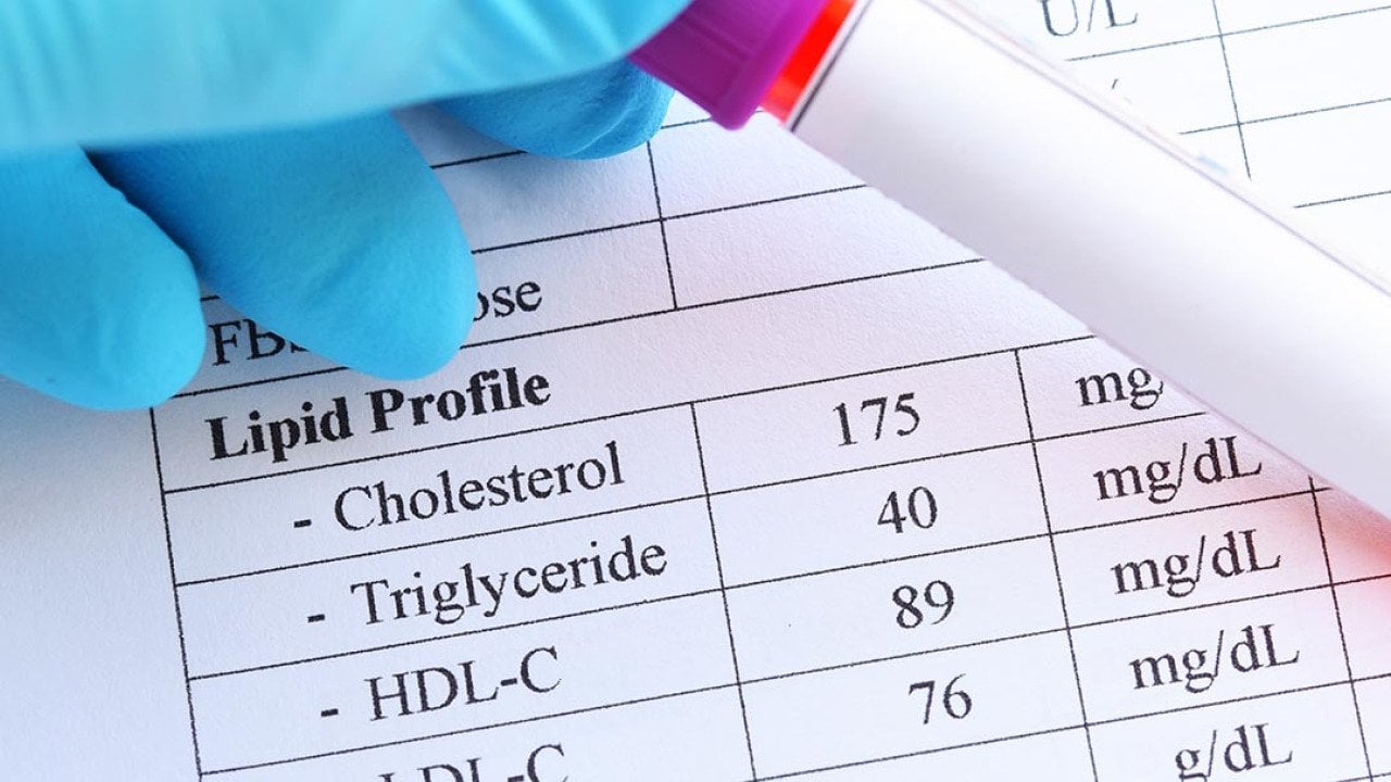 A blood sample in a test tube tube held in front of a printout of lipid profile test results. 
