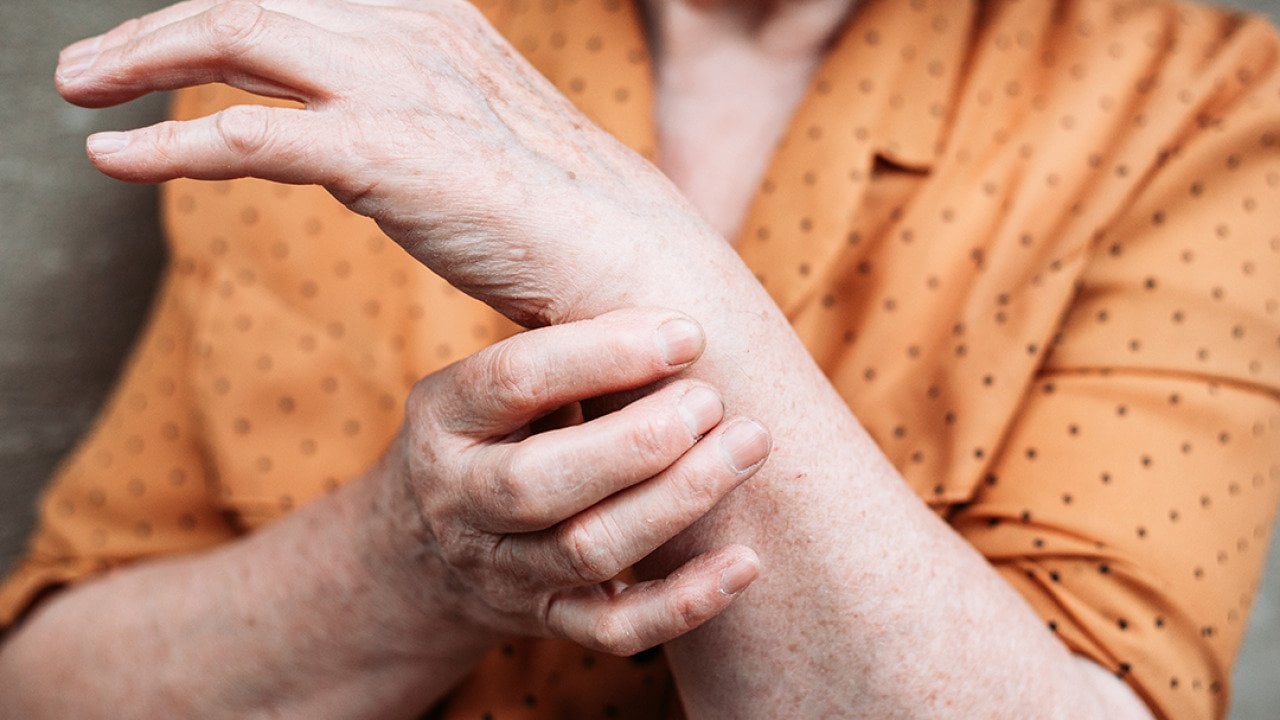 An elderly woman's hands experiencing pains.