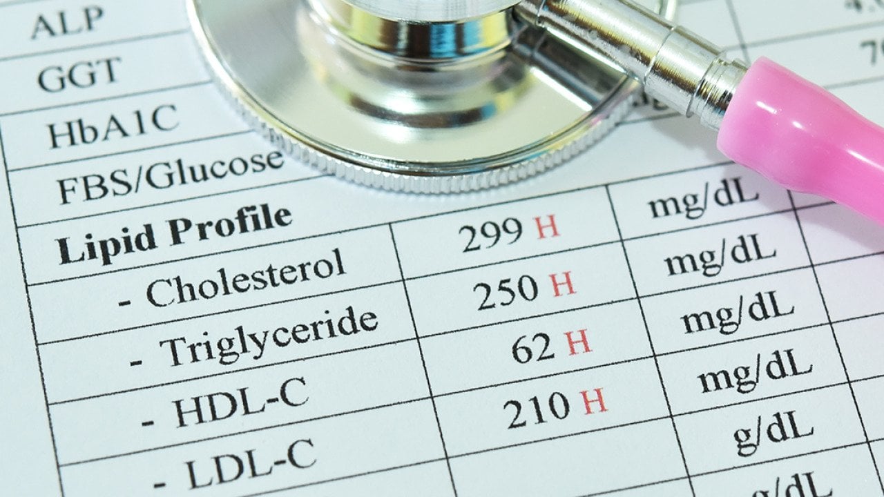 A stethoscope over a lipid test document with high results.