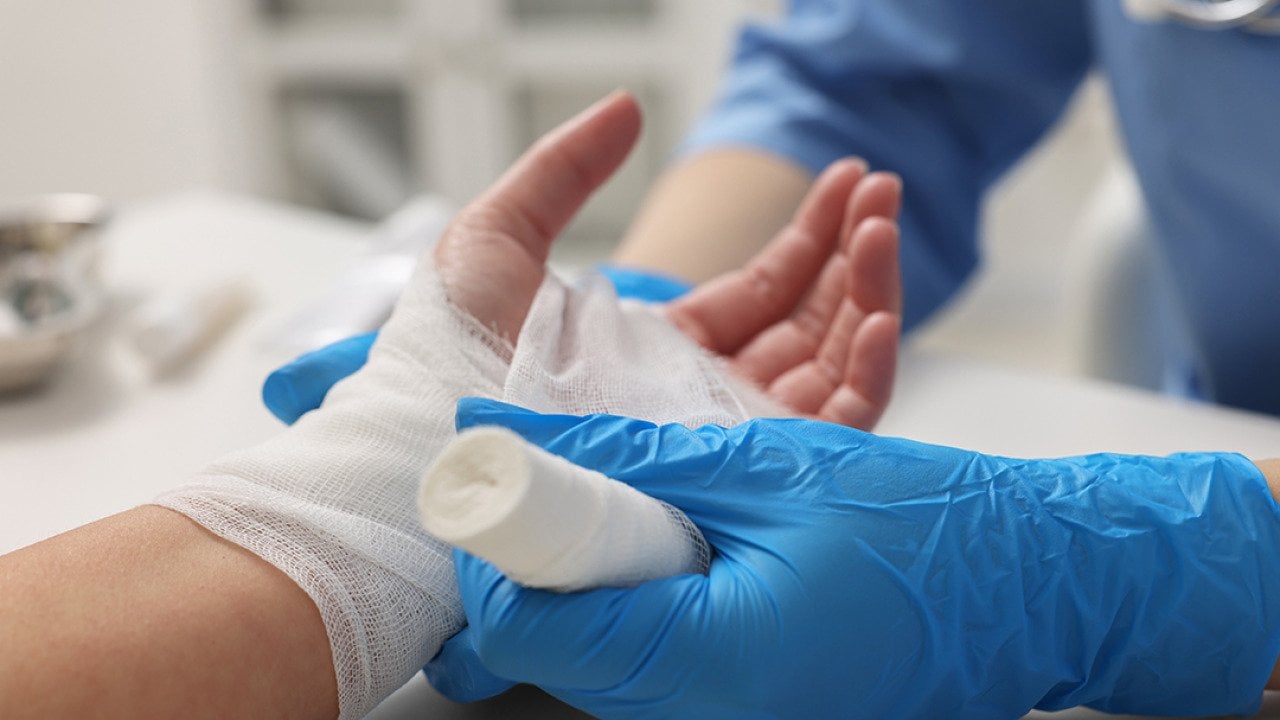 A doctor bandaging a patient's burned left hand.