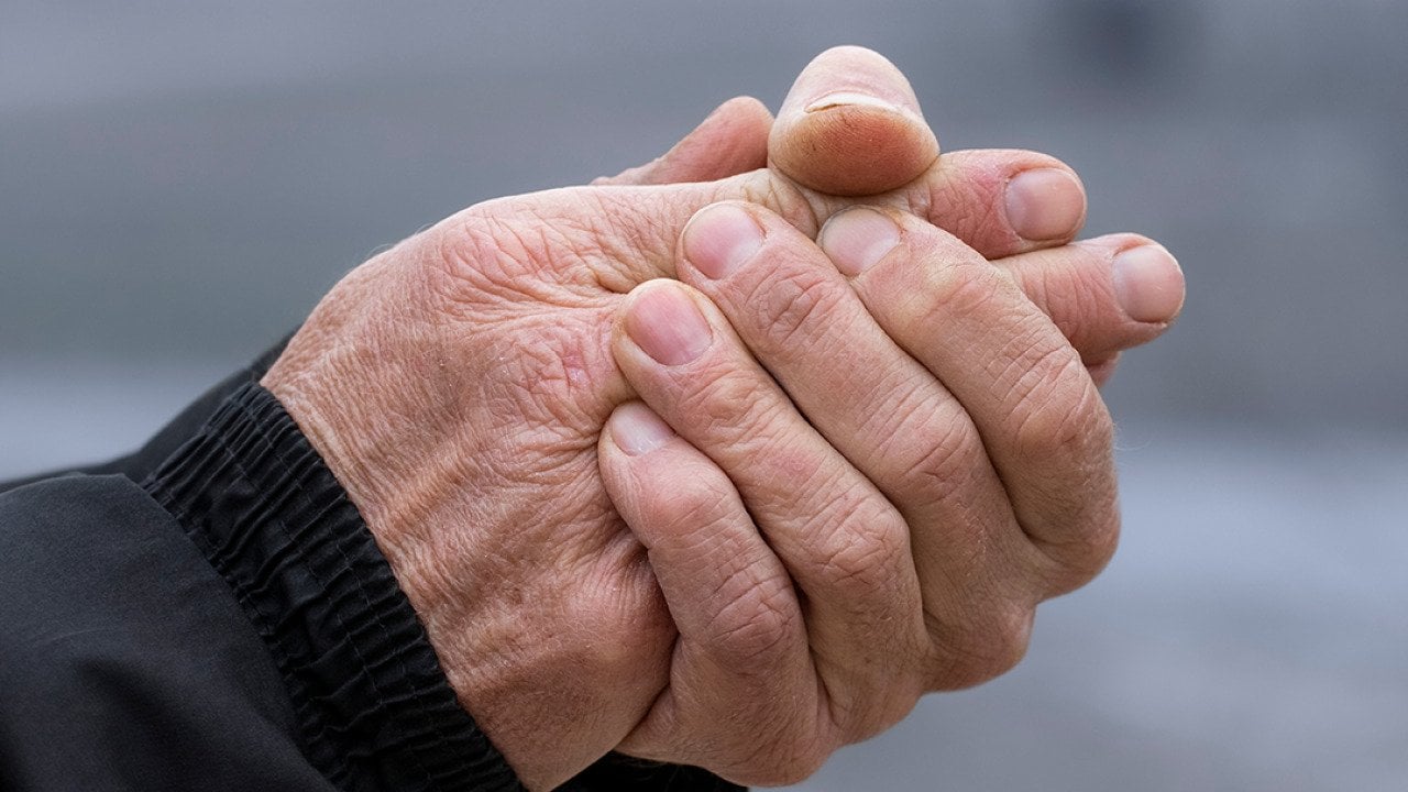 A senior person's hands drying out due to cold weather.