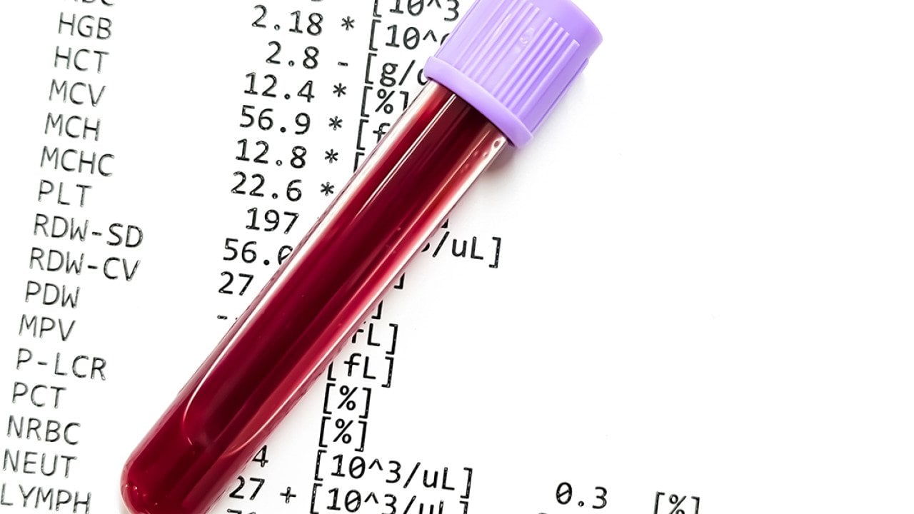 A blood sample over a CBC report document.