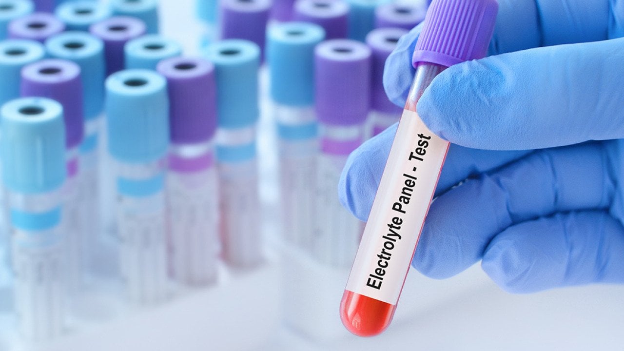 A blood sample tube with an electrolyte panel test label.