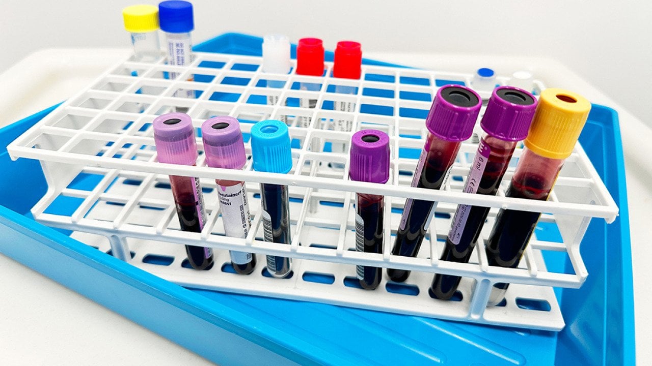 More than 74,000 older adults seek measles immunity tests amid US outbreaks