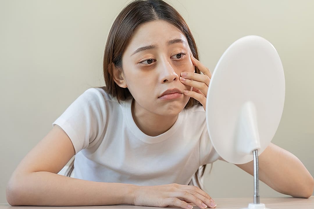 A young woman checking her dark under eyes in front of a mirror.