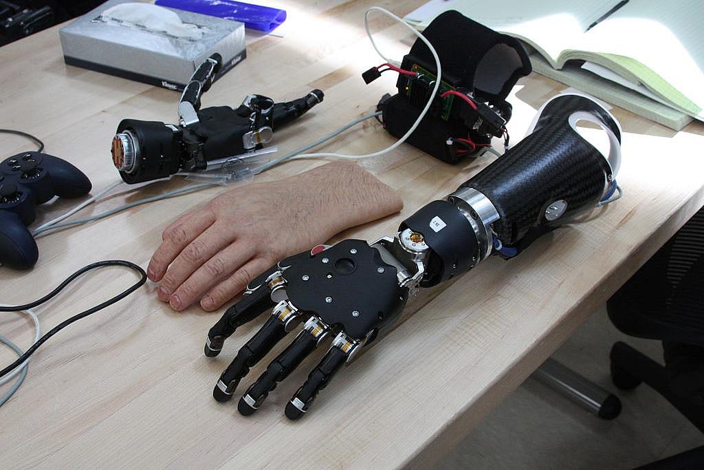 #51: Orthotists and prosthetists
