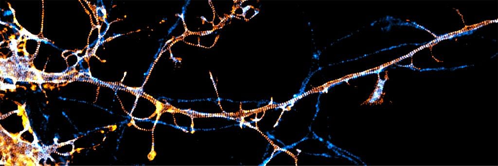 Specialized microscopy techniques have revealed that nerve cells have a special type of internal skeleton called the membrane-associated periodic skeleton, regulated by a protein called parallemin-1 (fluorescently labeled in this image).