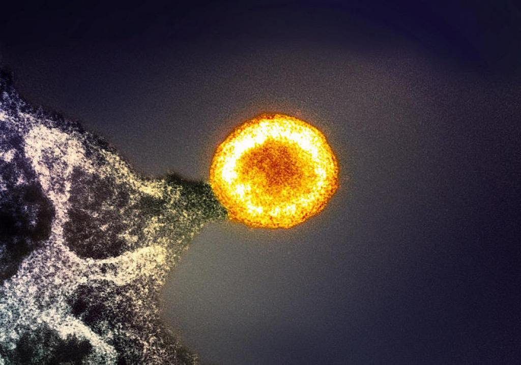 An HIV particle budding from an infected T cell. A single HIV-infected T cell can release thousands of new virus particles before dying, although not all of them will be capable of infecting other cells.