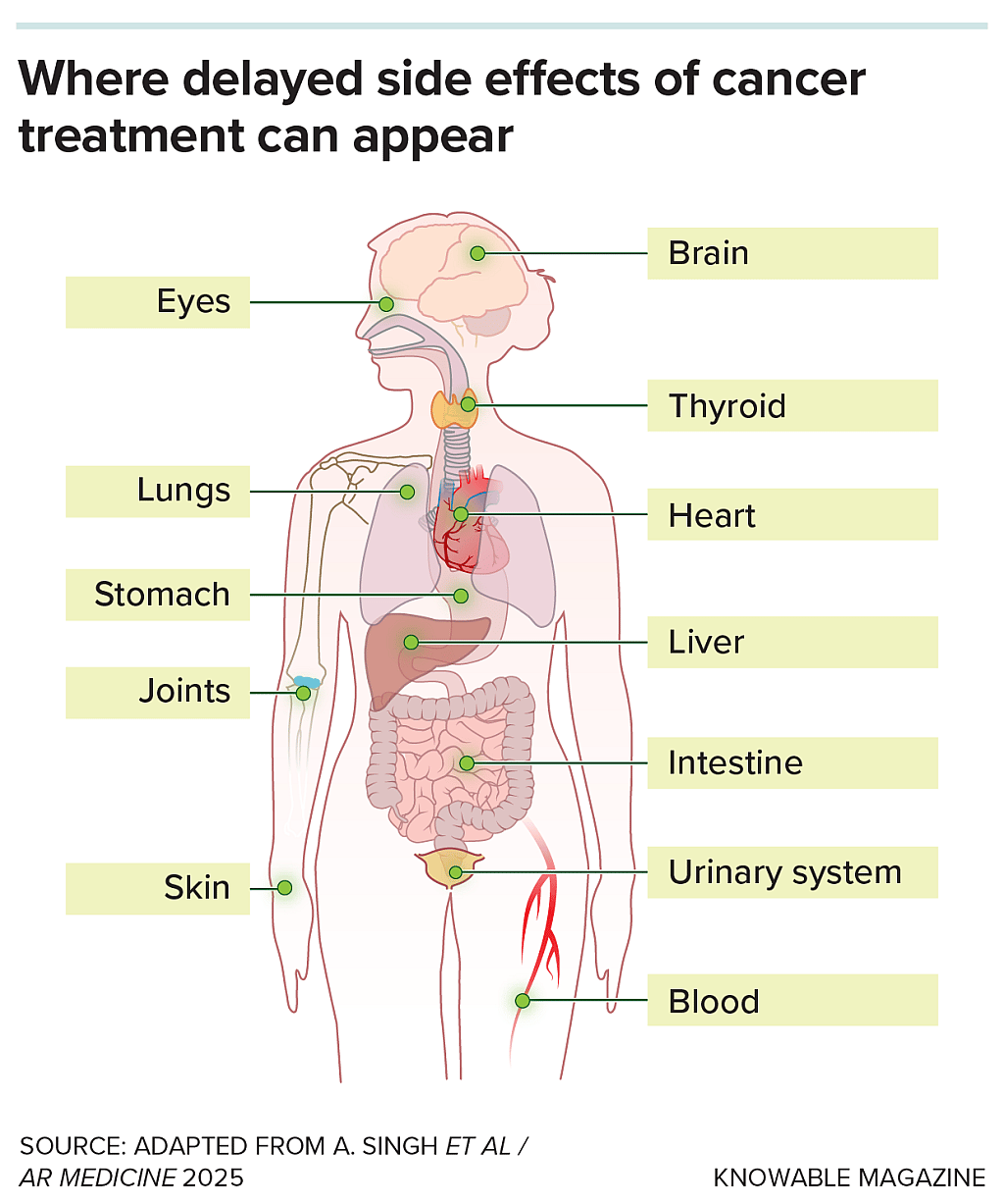 Infographic showing that cancer treatment often involves highly toxic chemotherapy and radiation, and where delayed effects and problems can appear years or even decades later in organs throughout the body.