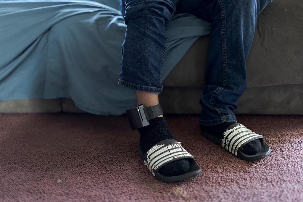 José Edilberto Molina-Aguilar is required to wear an ankle monitor from ICE while his asylum case is still pending.