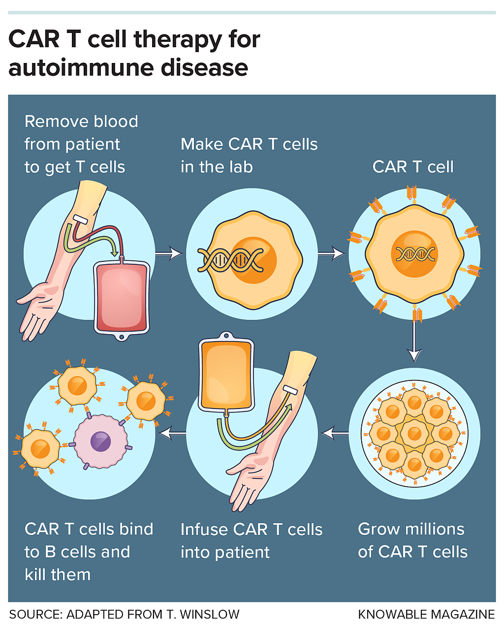 Graphic showing one of the many variations on CAR T procedures with the basic process involving removing, modifying and re-infusing patient T cells so they can attack their target, which is B cells in the case of autoimmune disease.