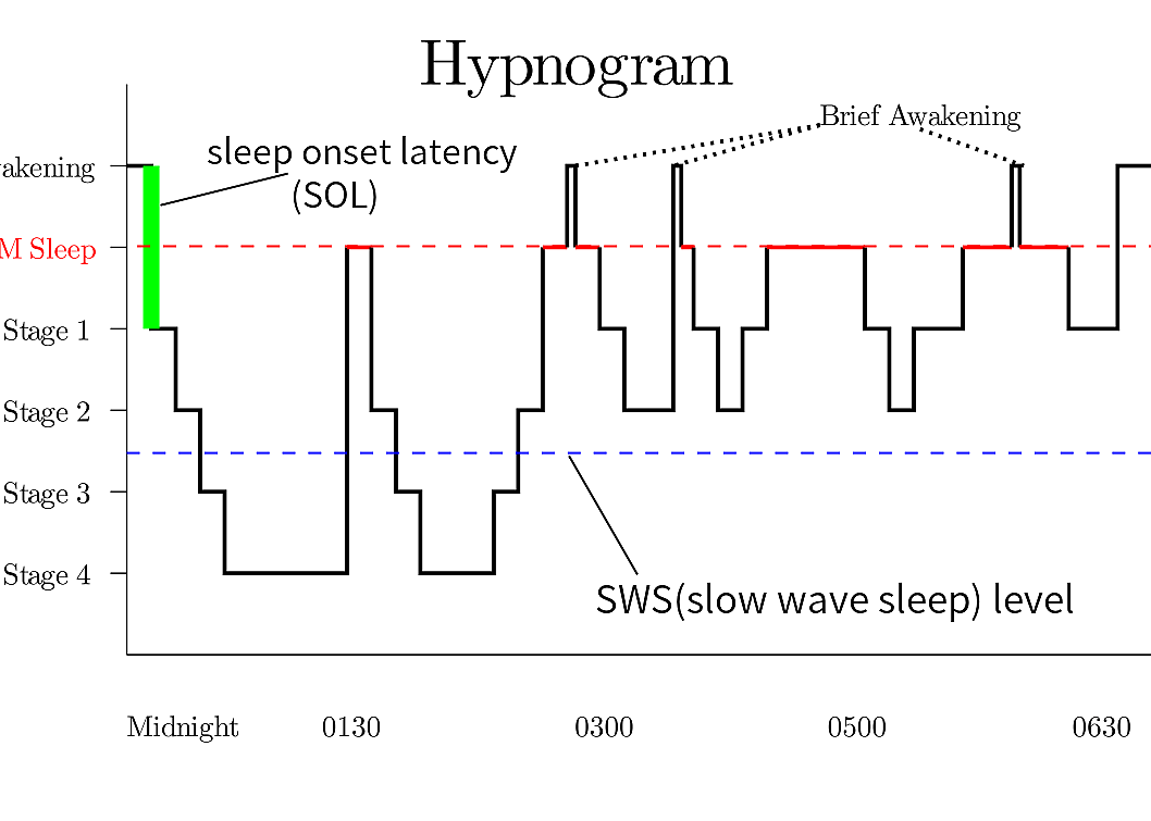 1953: REM sleep stage identified