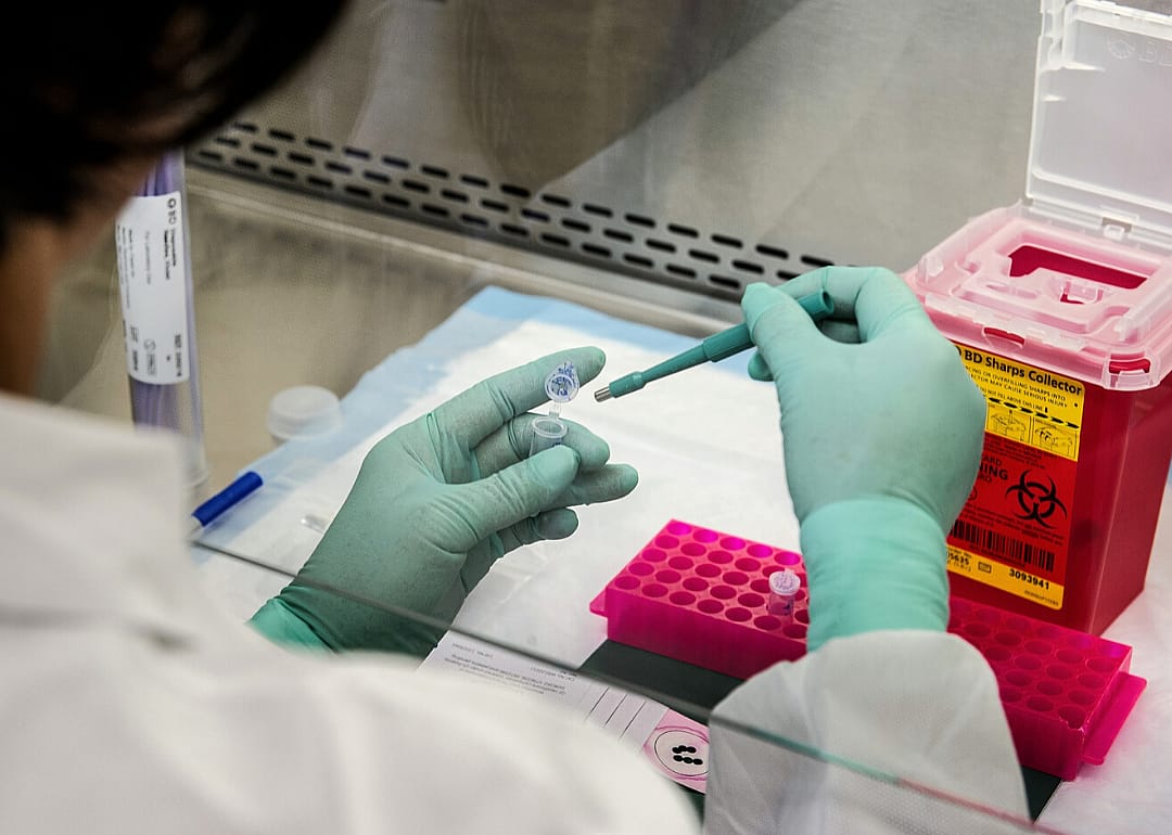 Interpreting PCR test results