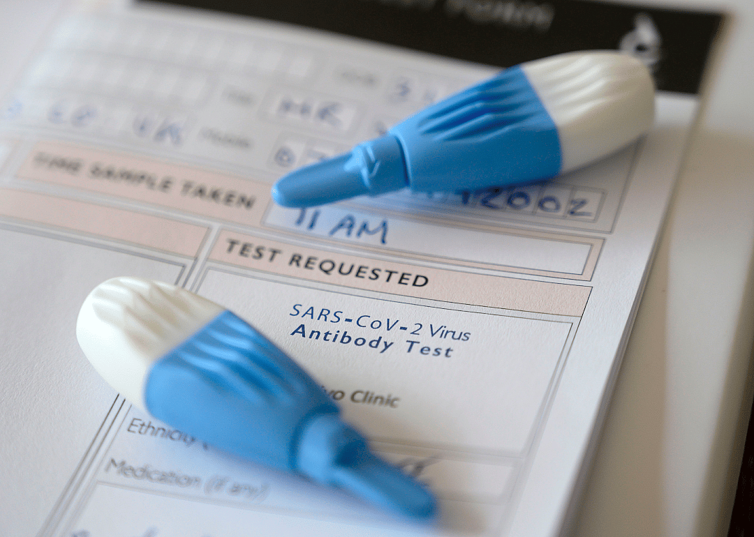 Antibody COVID-19 test