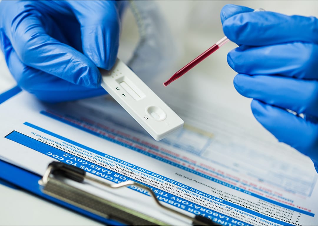 Antibody test accuracy
