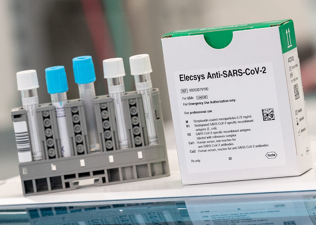 Roche Diagnostics