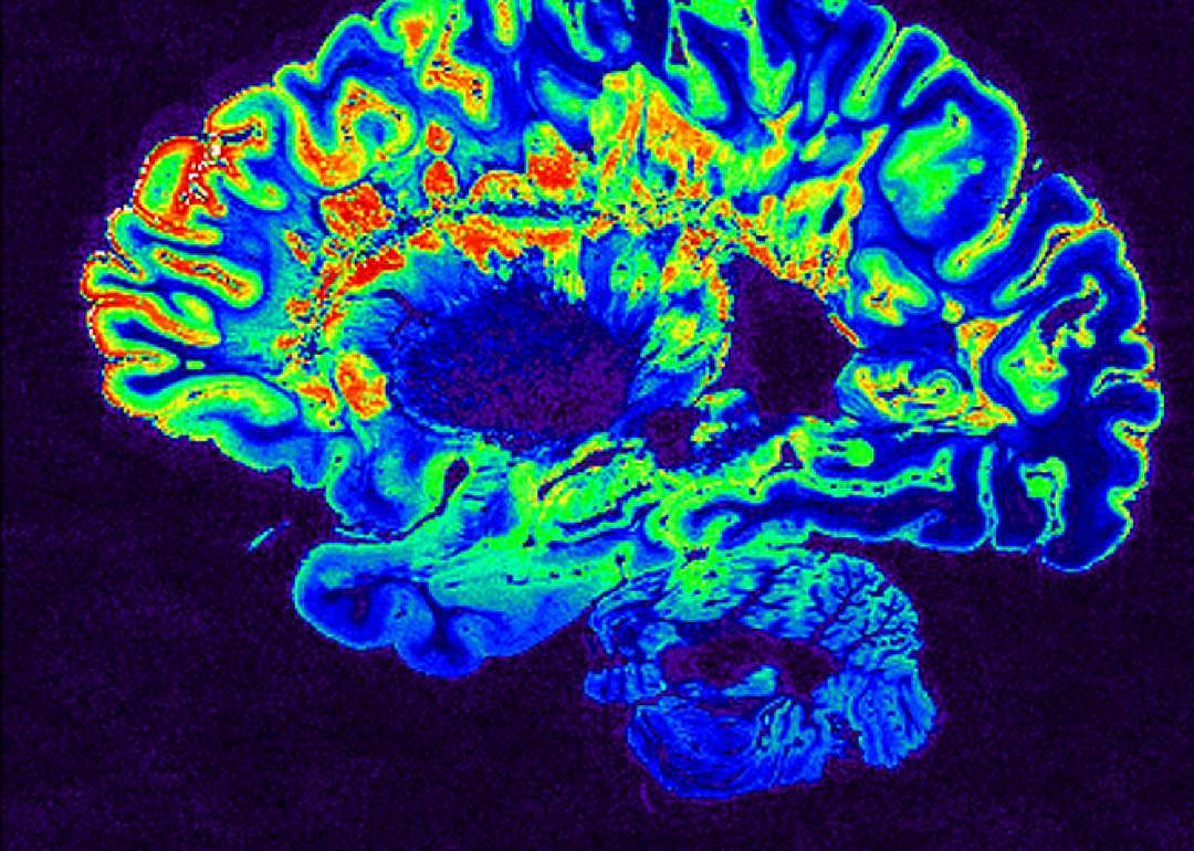 #93. Neuroscience