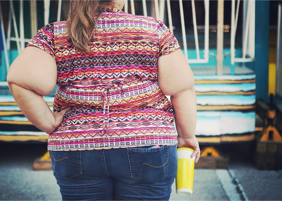 Obese population: COVID-19 connection
