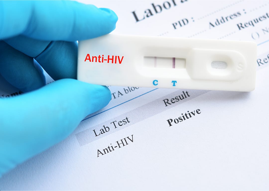 HIV diagnosis: COVID-19 connection