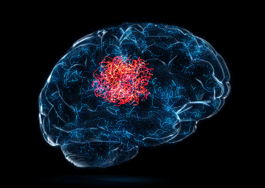 An digital scan of a brain with one area highlighted in red. 