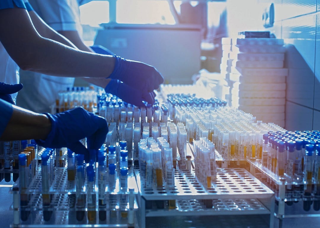 A close up of laboratory assistants hands in blue rubber gloves touching multiple tubes. 