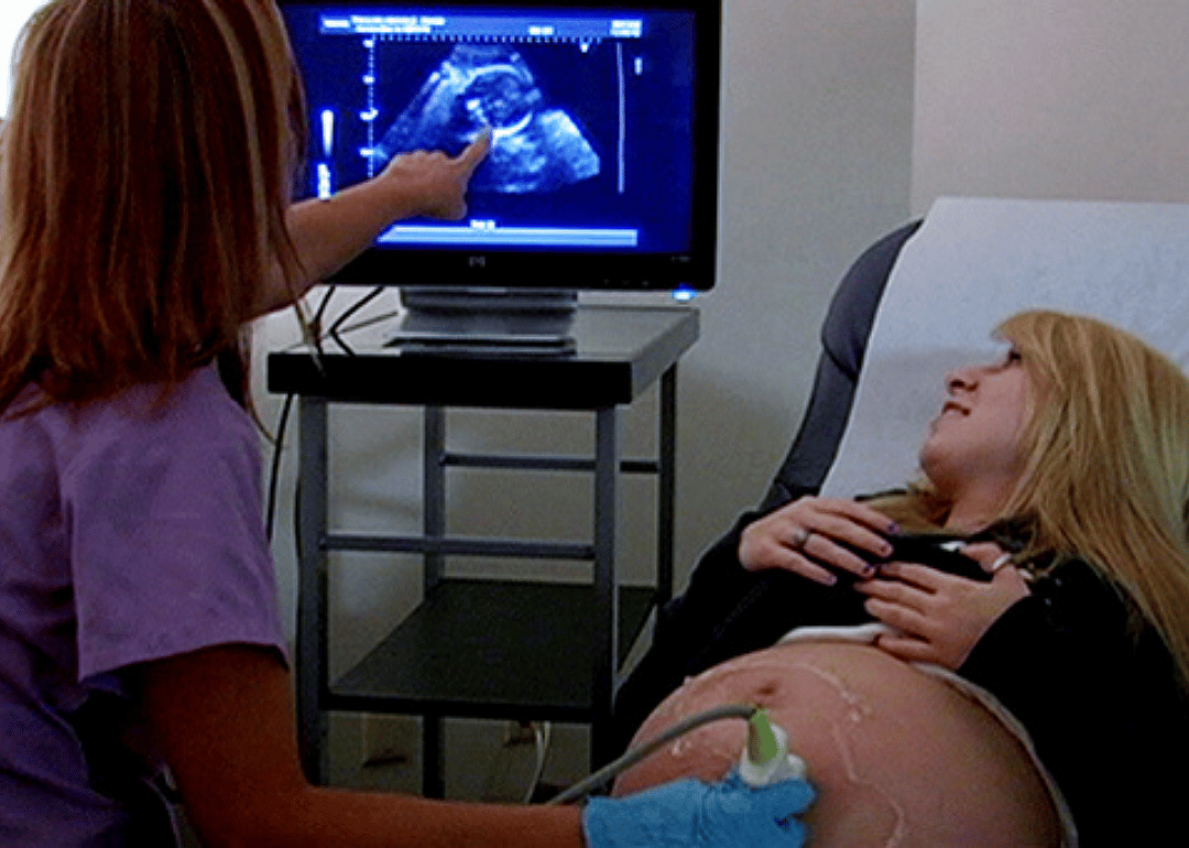 A woman gets an ultrasound.