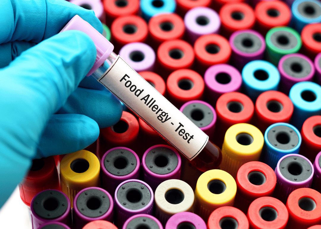 There is no cure for food allergies