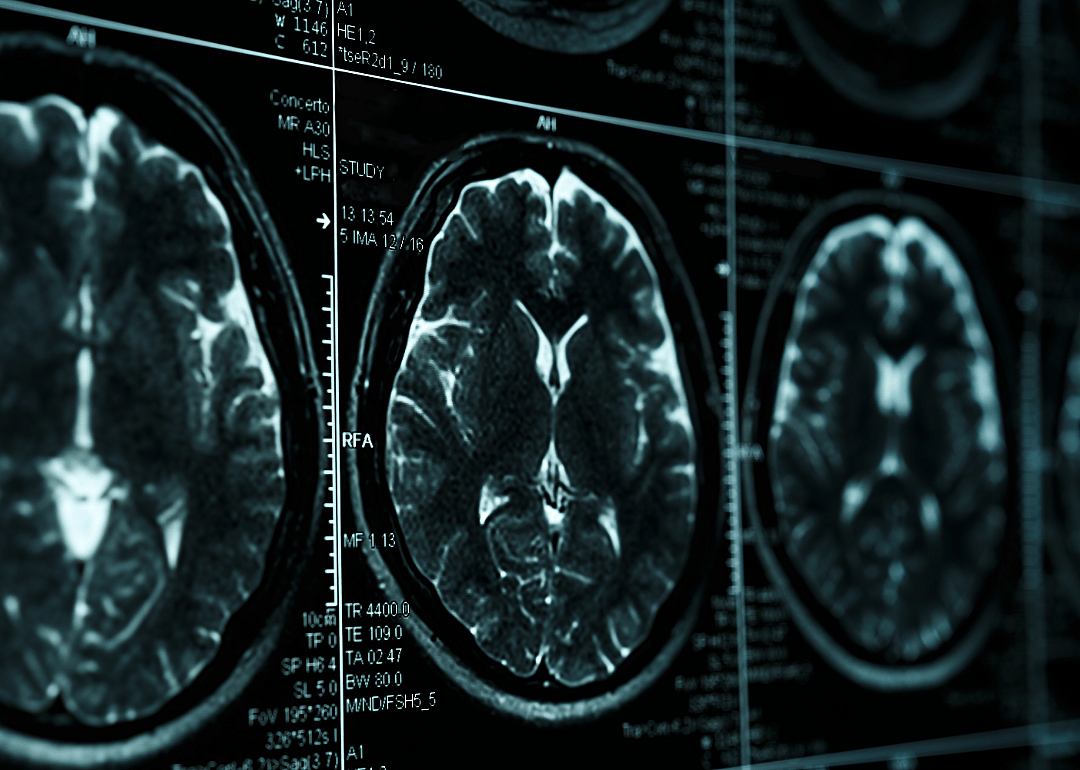 #36. Brain/head injury (traumatic)