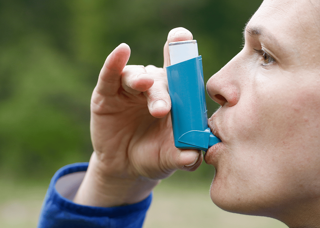 #33. Asthma