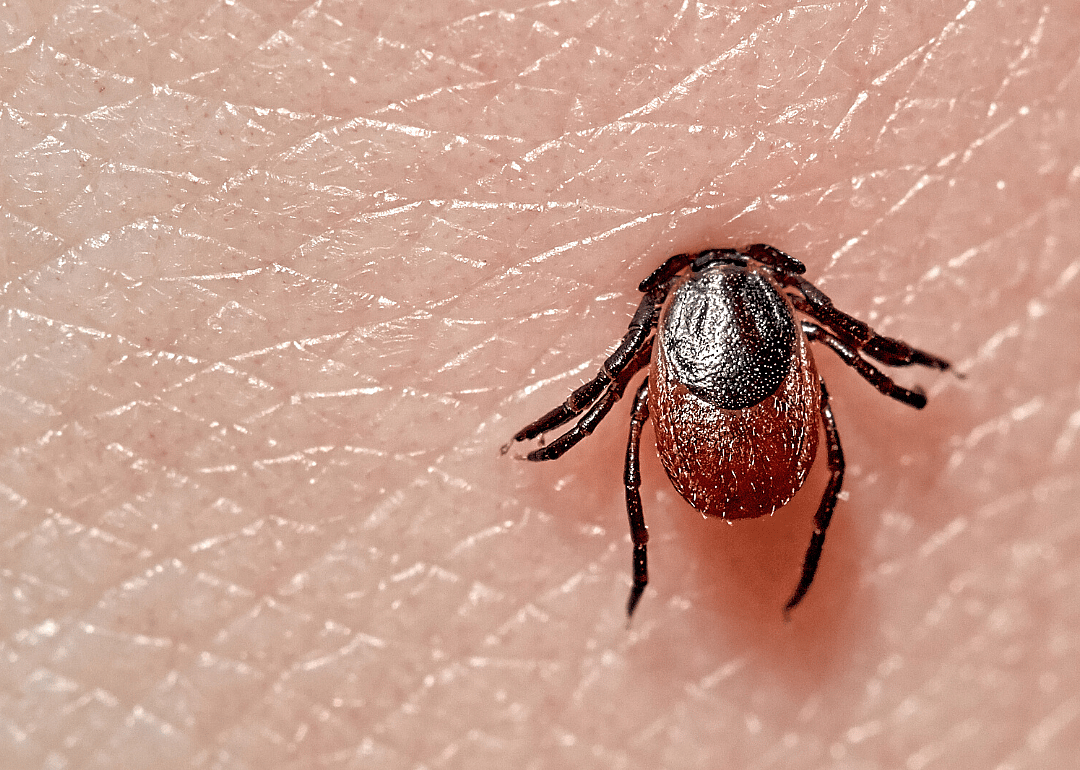 Lyme disease