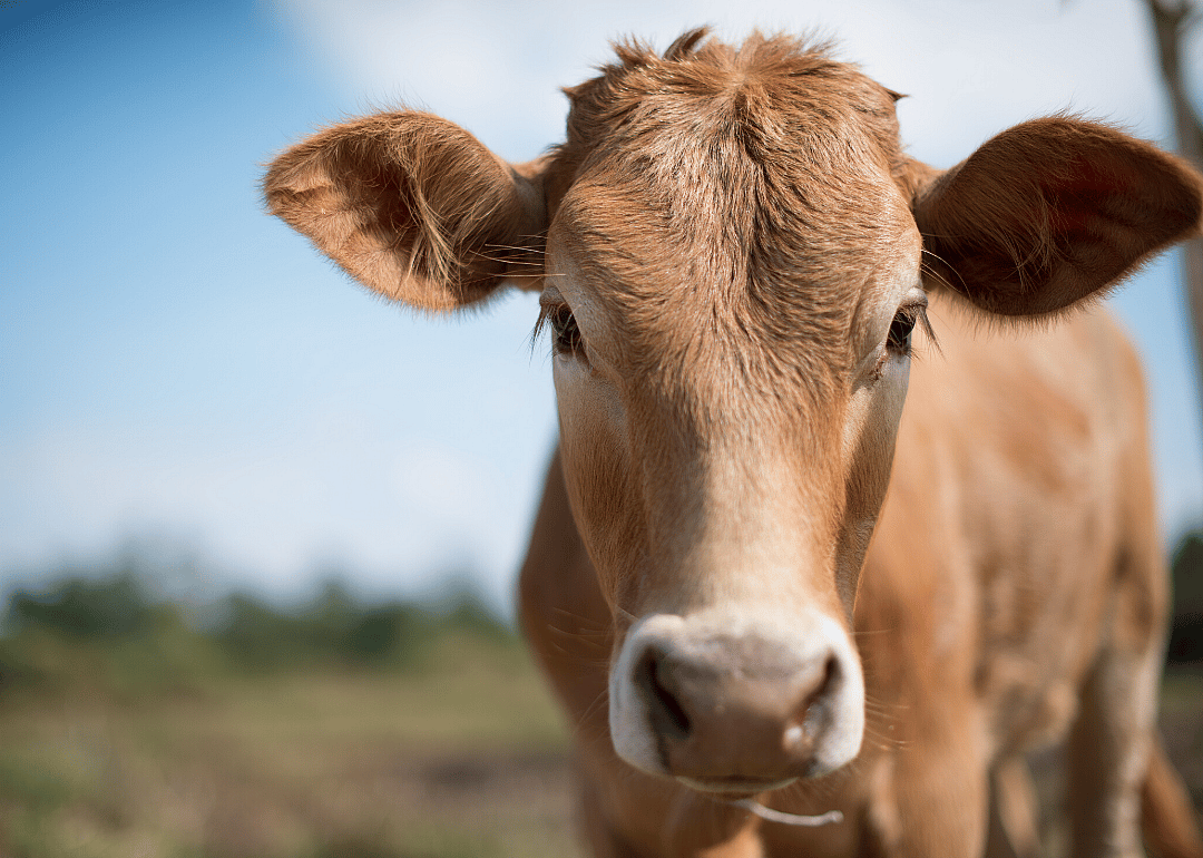 Creutzfeldt-Jakob disease (Mad cow)