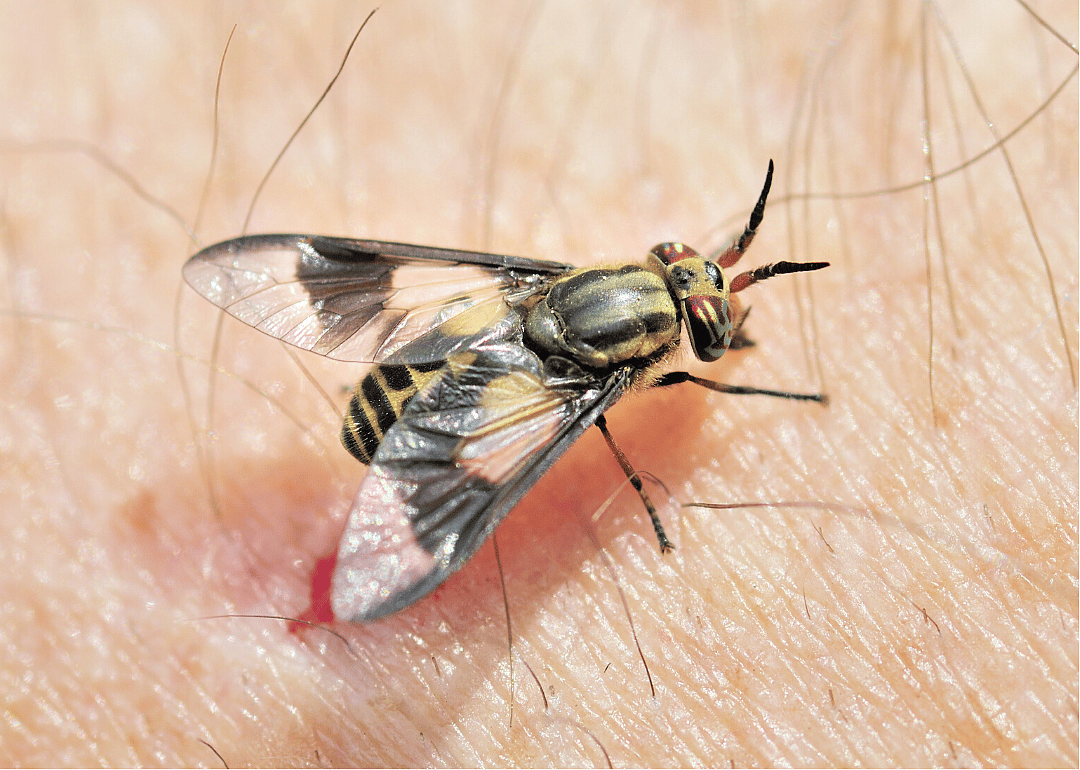 Tularemia