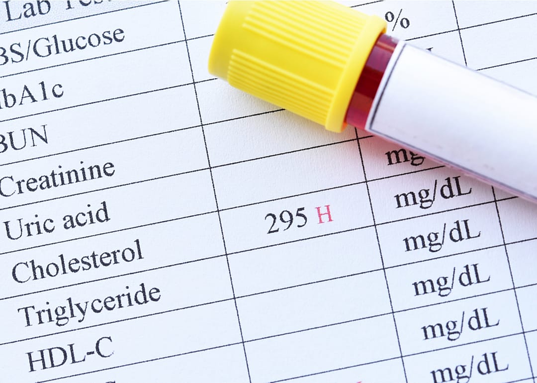 High blood cholesterol