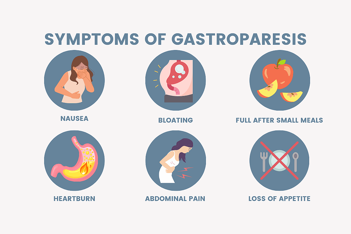  illustration of 6 common symptoms of gastroparesis