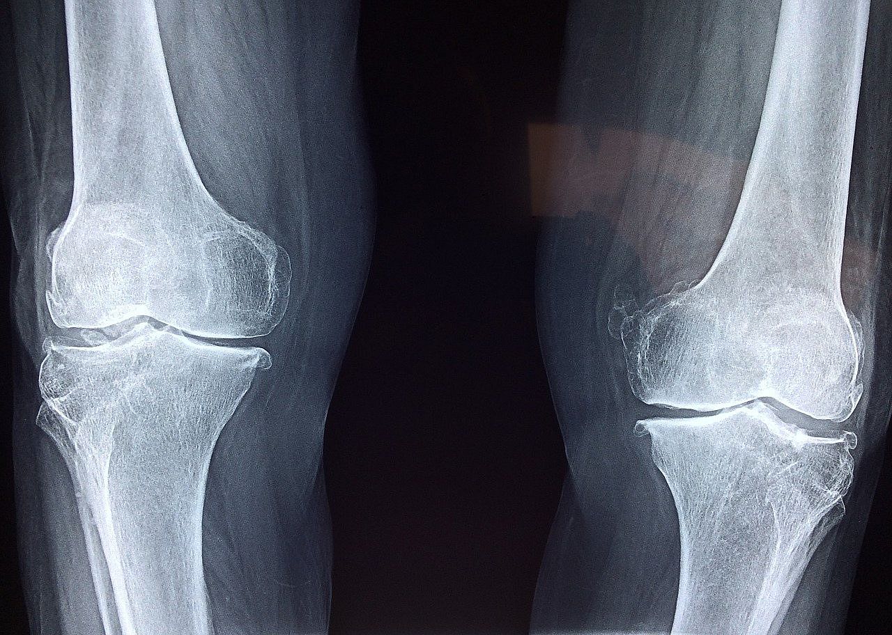 2020: Biologics used in orthopedic repair