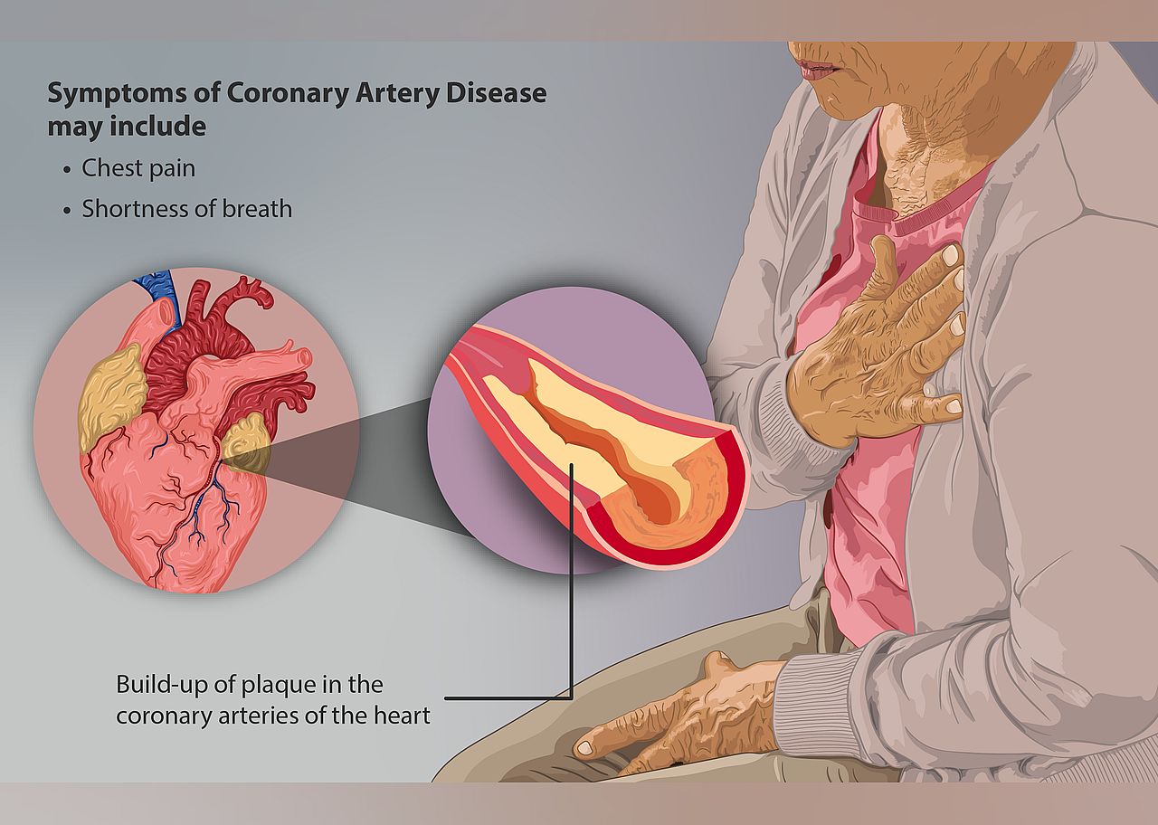 2008: Coronary disease reduced by 25%