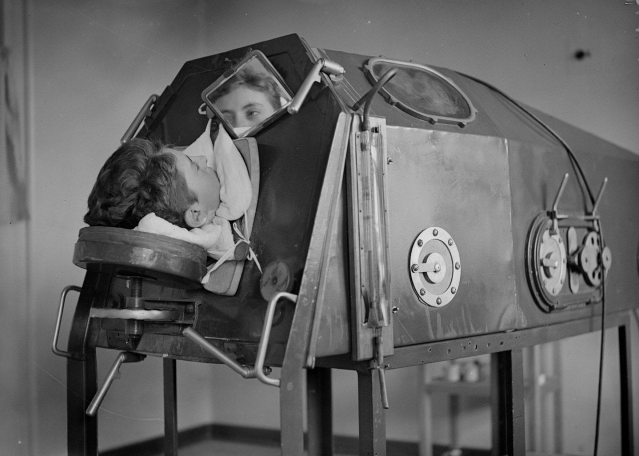 Child in an iron lung