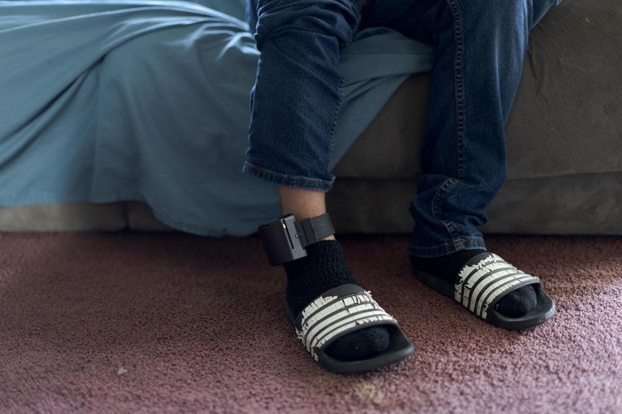 José Edilberto Molina-Aguilar is required to wear an ankle monitor from ICE while his asylum case is still pending.