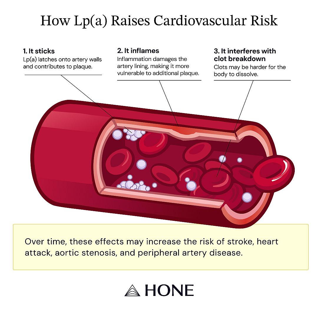 An illustration showing how Lp(a) raises cardiovascular risk.