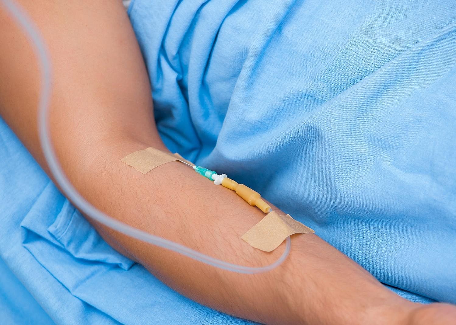 Convalescent plasma therapy