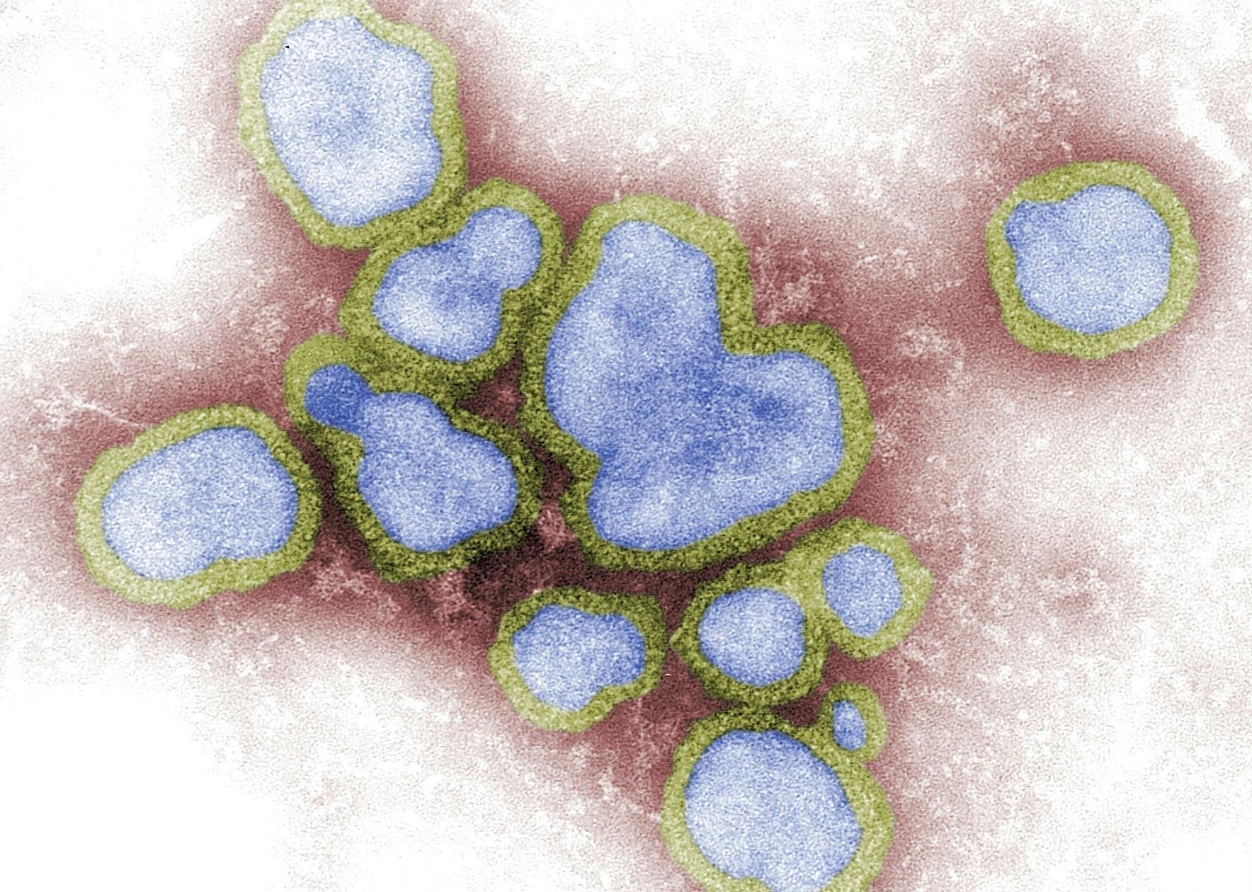 Virus