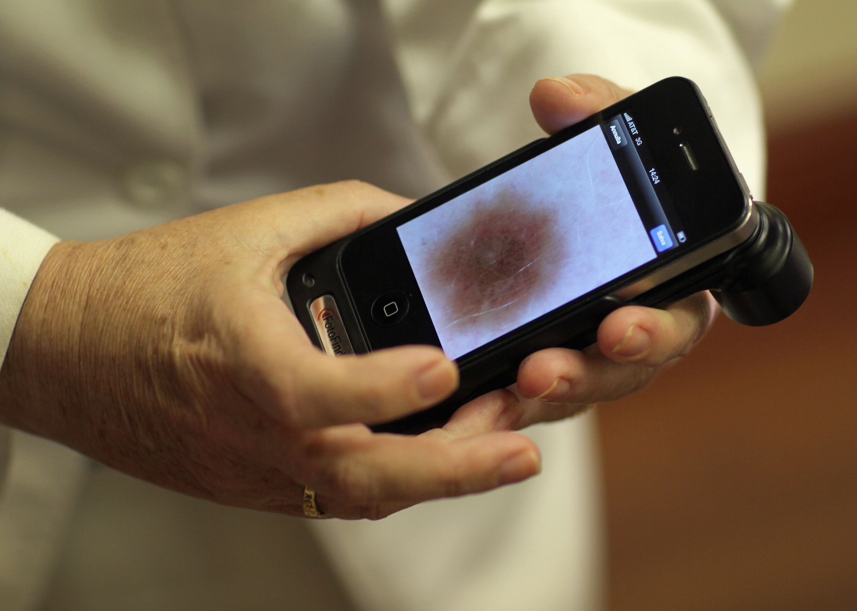 2011: Melanoma drug almost doubles survival