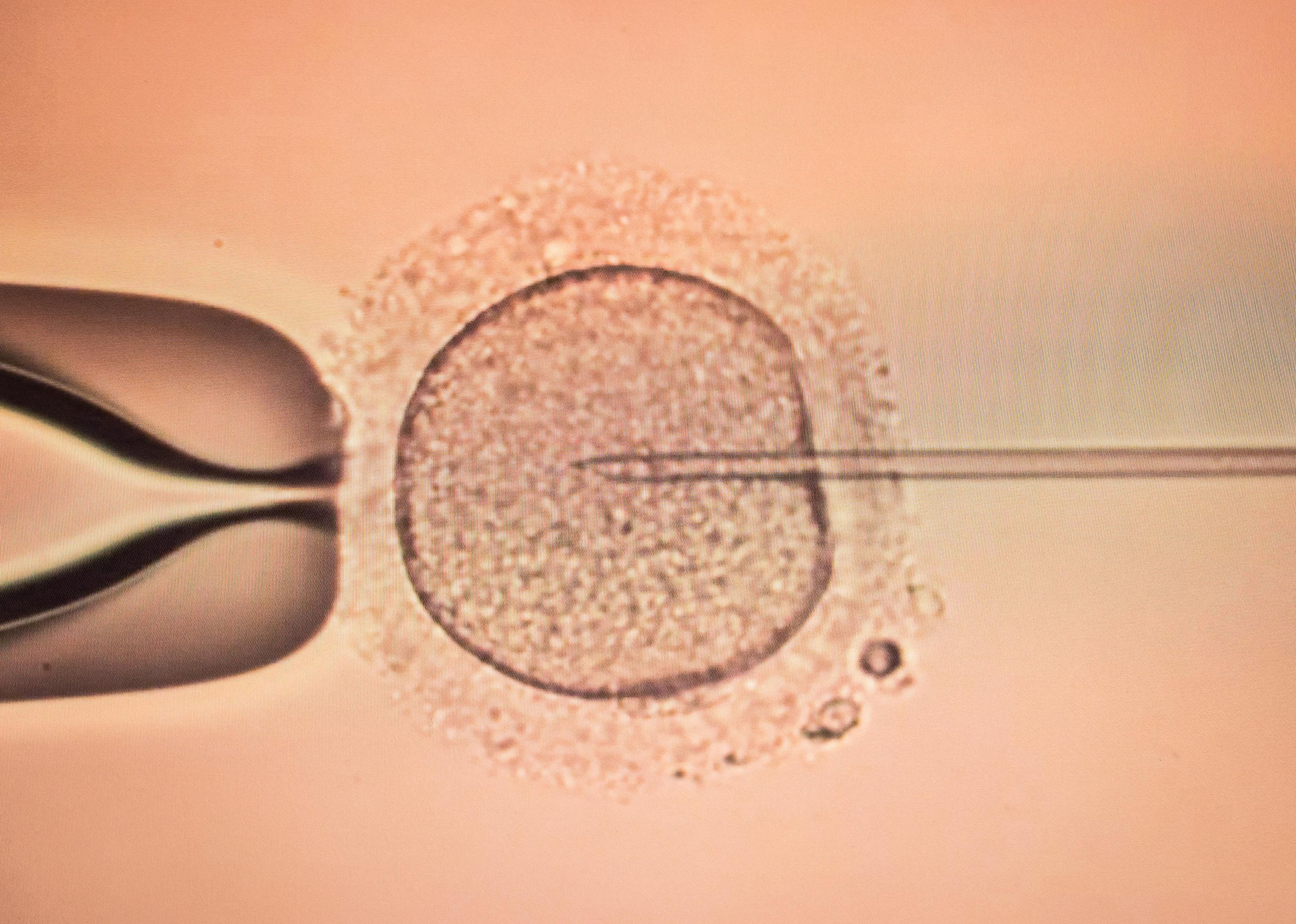 1977: In vitro fertilization