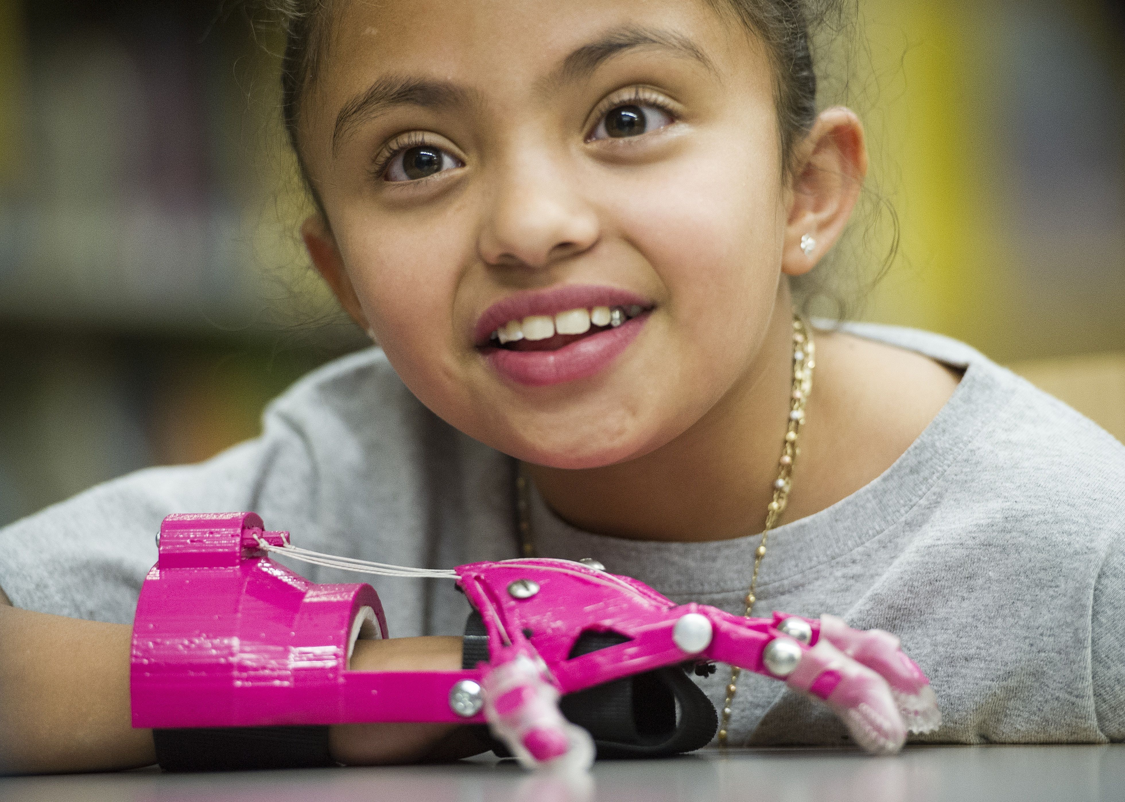 2013: 3D-printed body parts