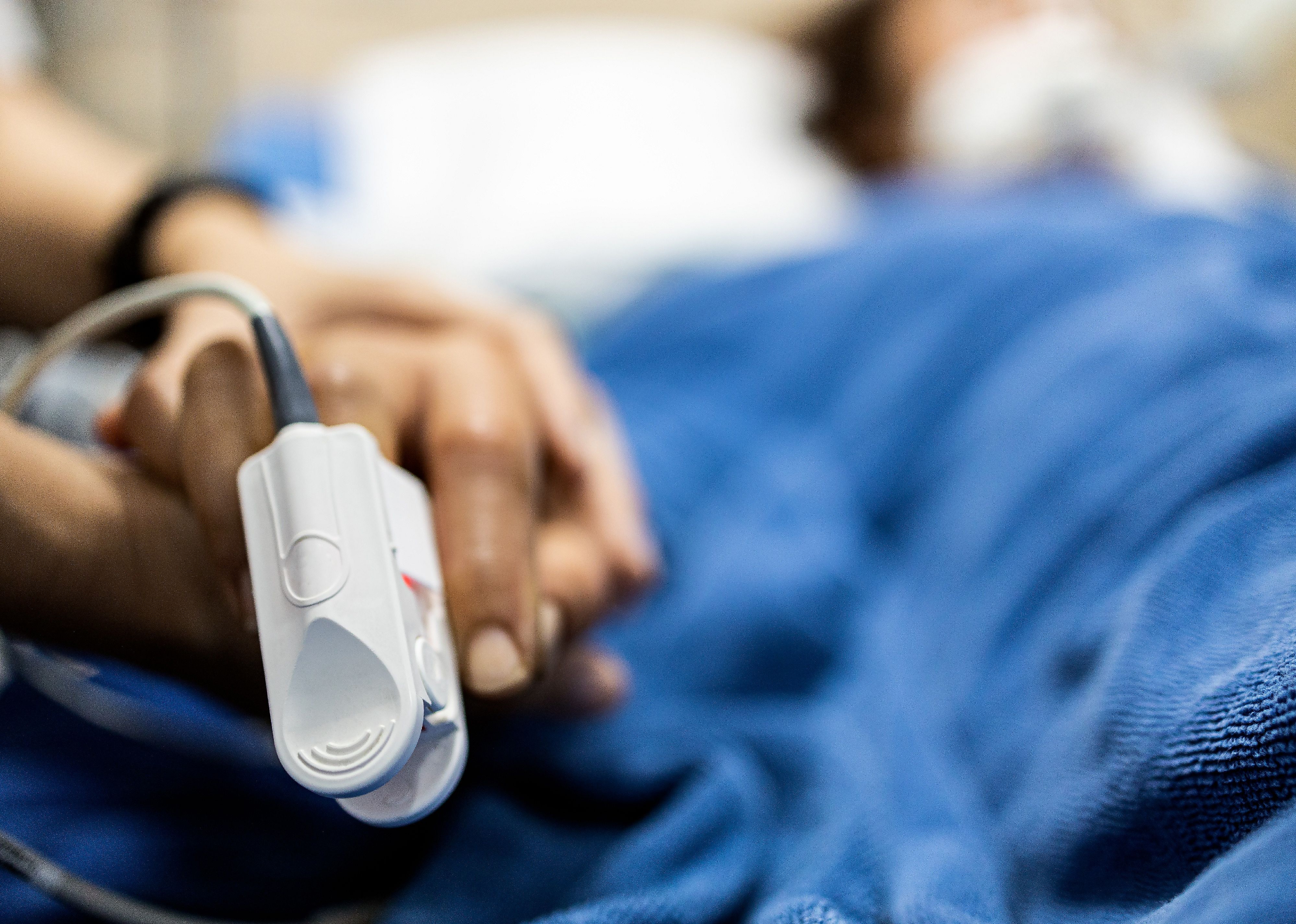 Patient's hand with an attached pulse oximeter on finger for monitoring.