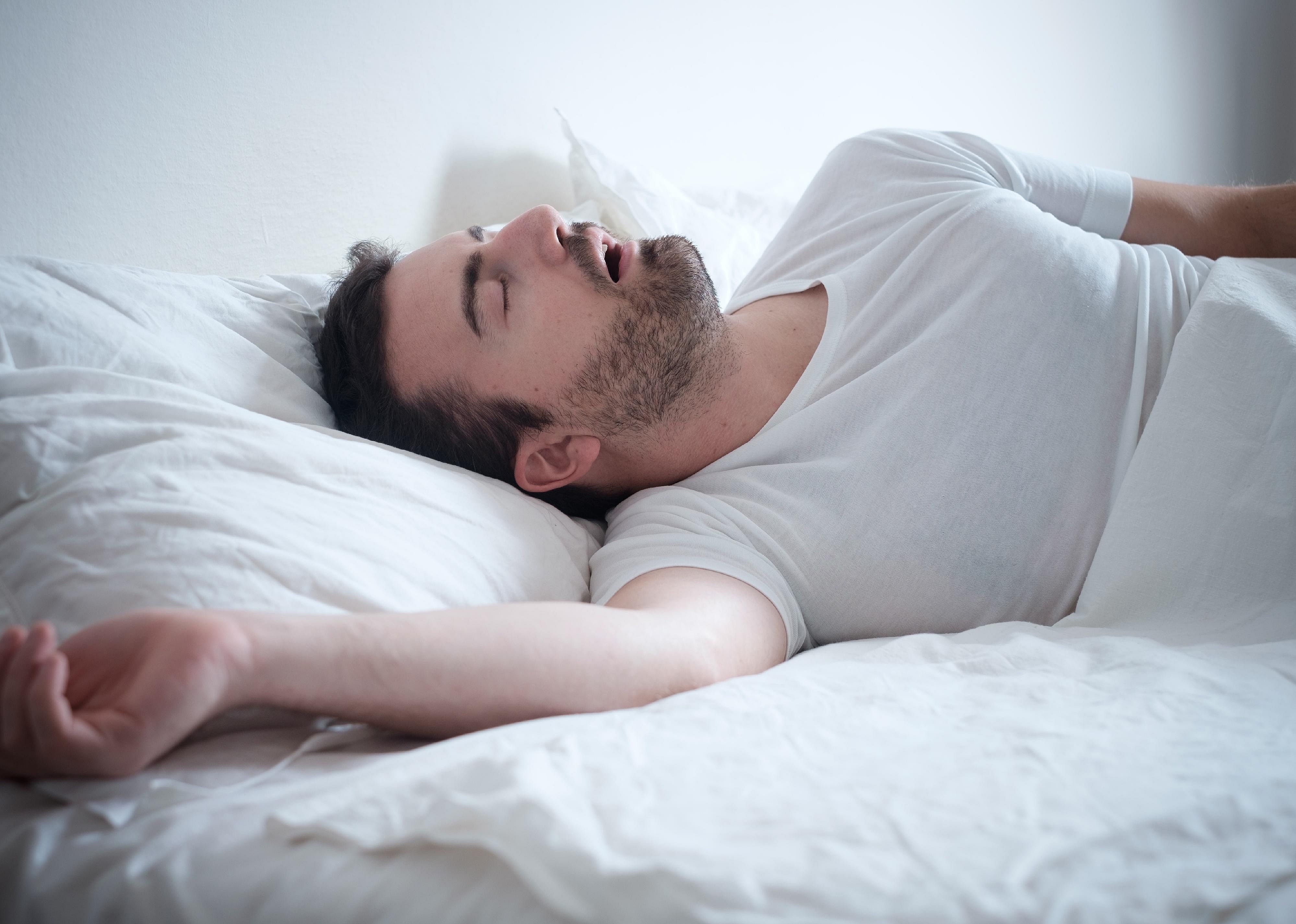 Obstructive sleep apnea