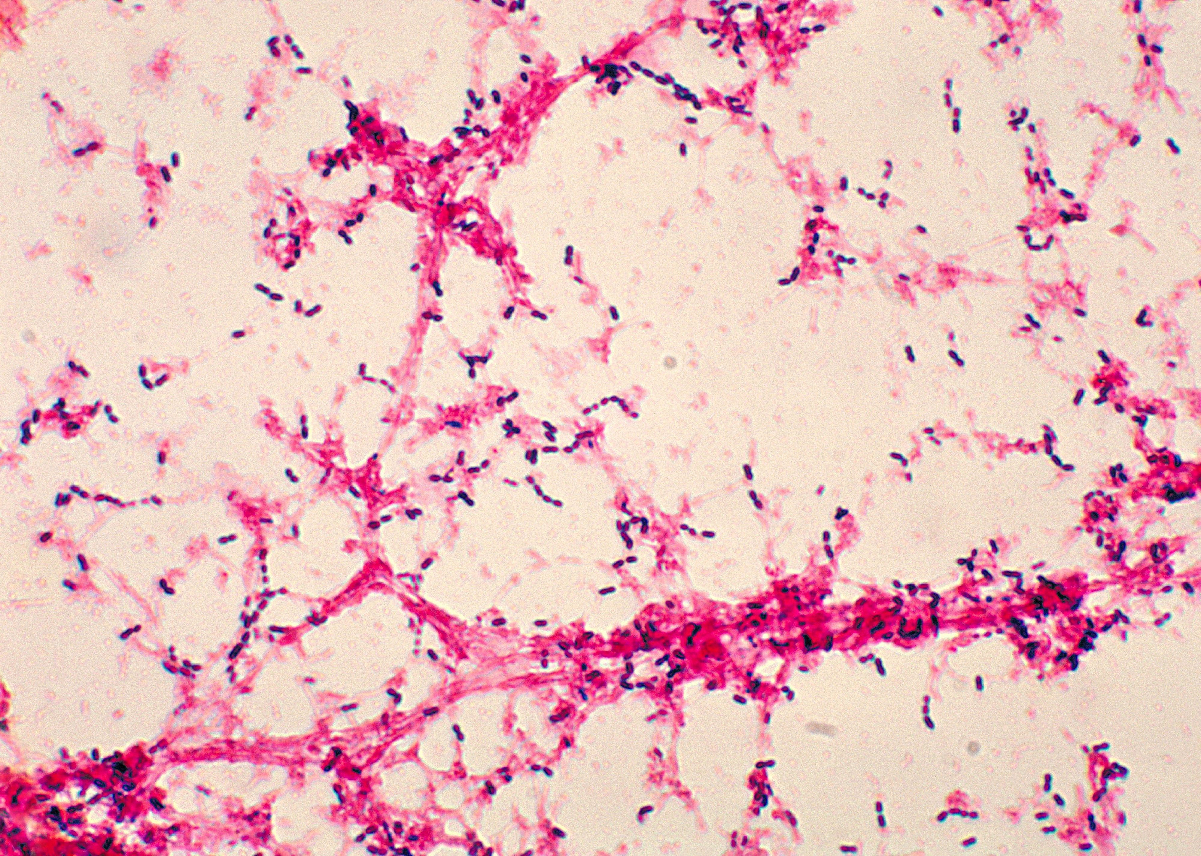 1977: First pneumococcal pneumonia vaccine
